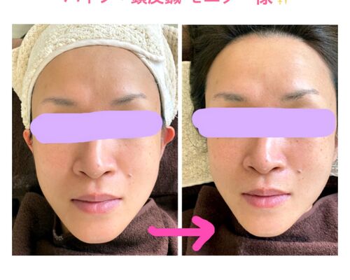 2090D5A1-C004-4647-A57E-48838E1F3355